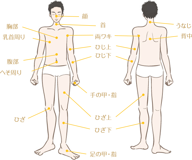 メンズ脱毛の部位